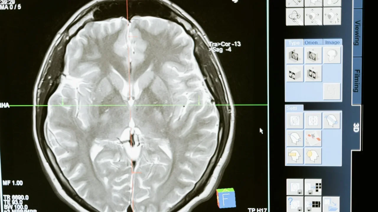 Online Test Brain